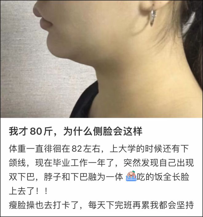 體育博彩：很難說這個bug和頭禿哪個更致命